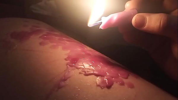 Wax play (Tím) - Masochist transman nhỏ giọt Sáp nóng lên đùi dày khi đeo đùi đến đầu gối