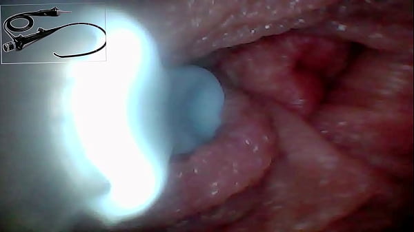 Exclusive: Camera Goes Inside &ndash_ We Found My G-Spot and Captured 5 Orgasms!